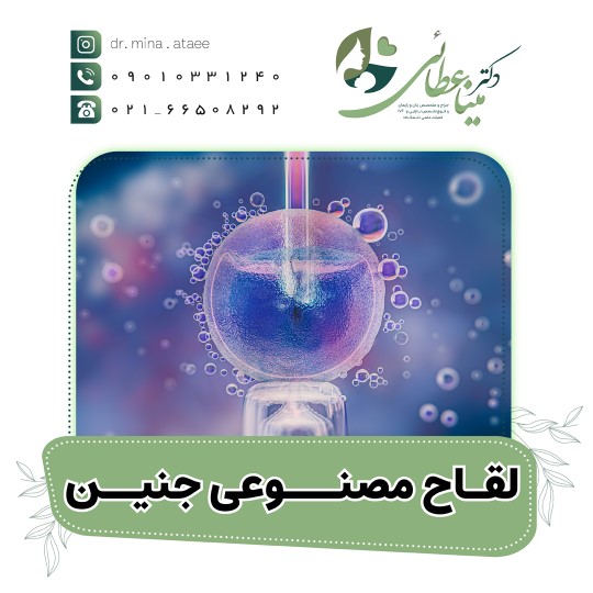 IUI ، IVF و لقاح مصنوعی جنین