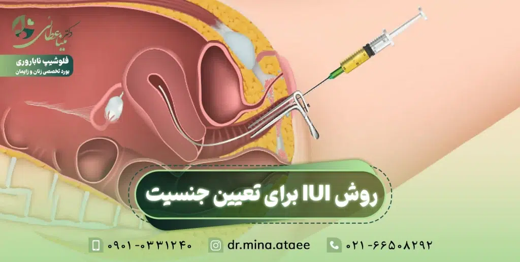 روشiui برای تعیین جنسیت
